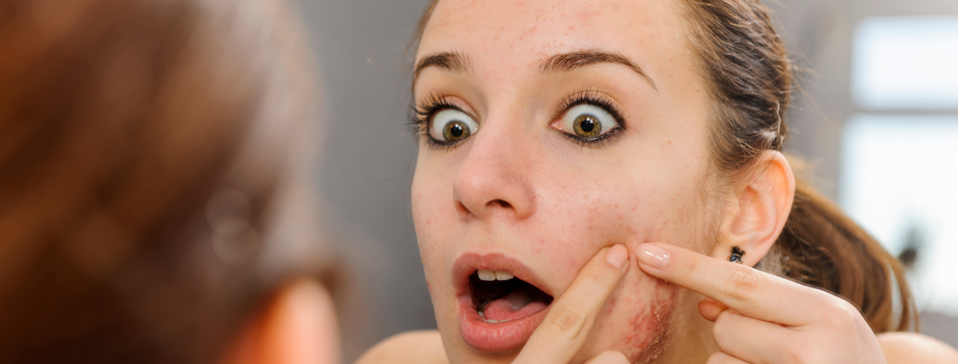 8 Signs you may be Progesterone Deficient