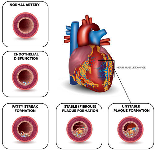 Cardiovascular Health Screening