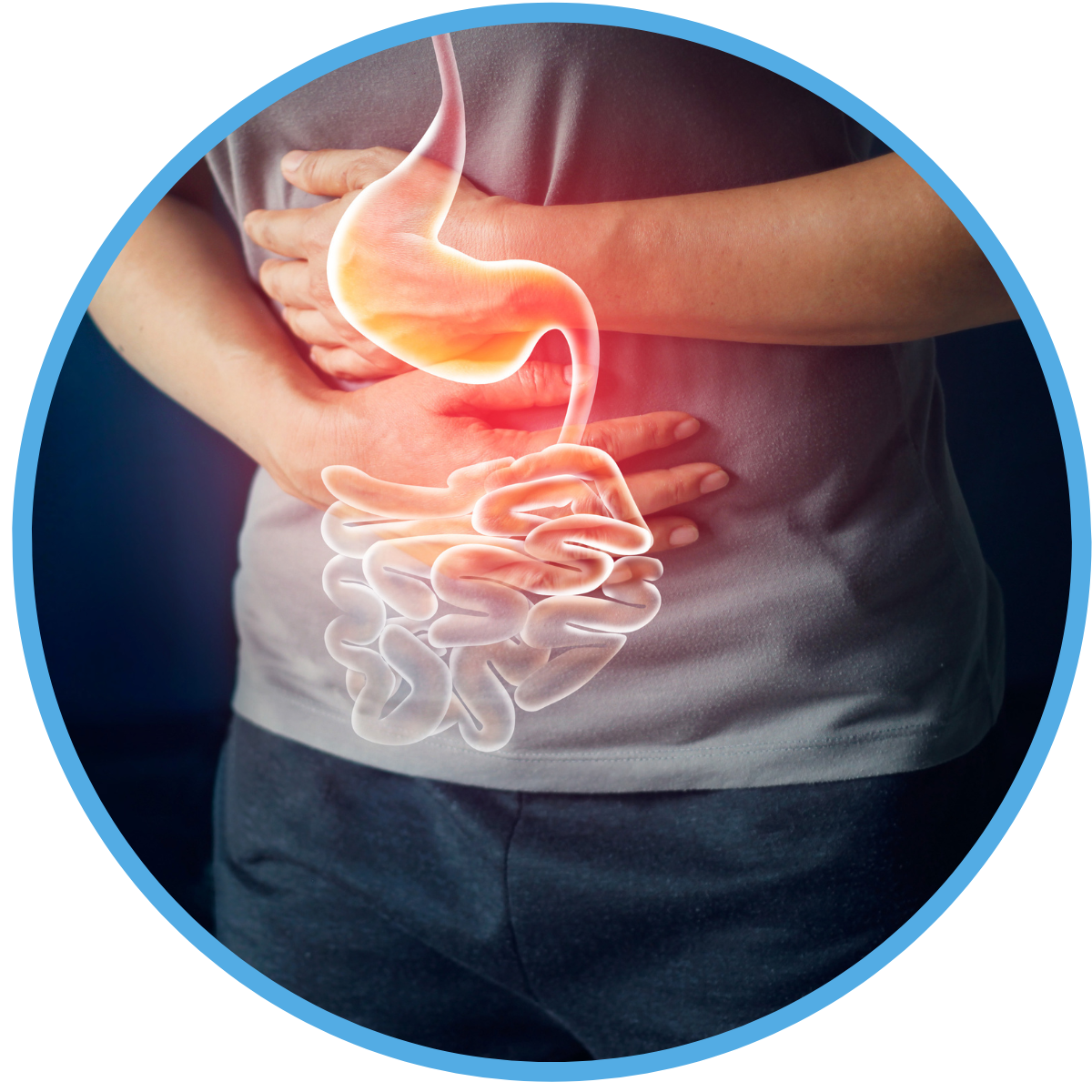 Hypnotherapy for IBS