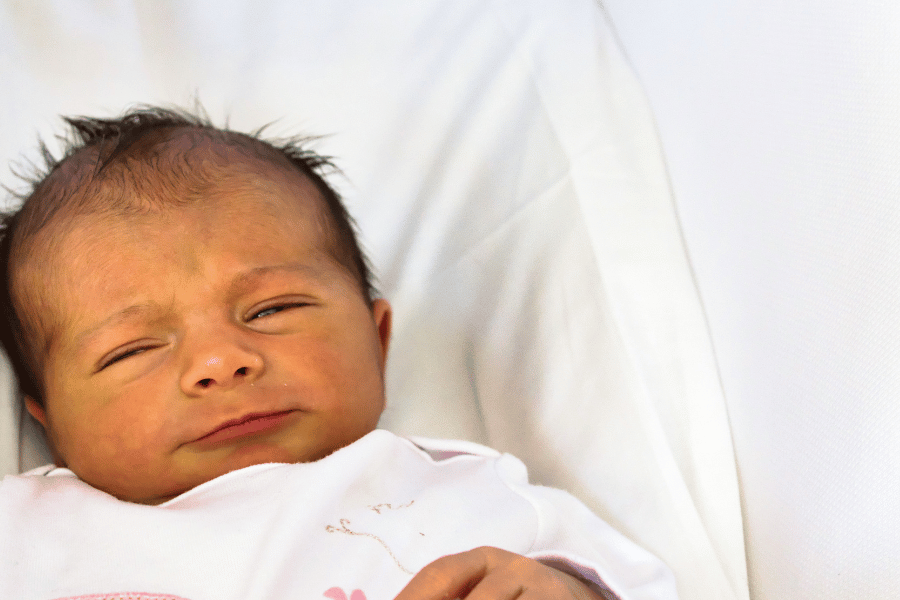 Photo of newborn baby with jaundice